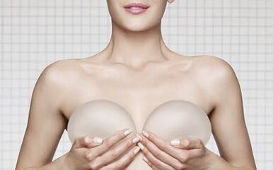 Breast expansion with implants