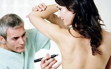 Surgical Method of Increase in Breasts
