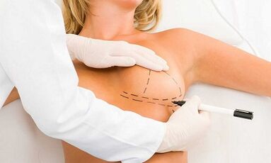 How to increase implants brain