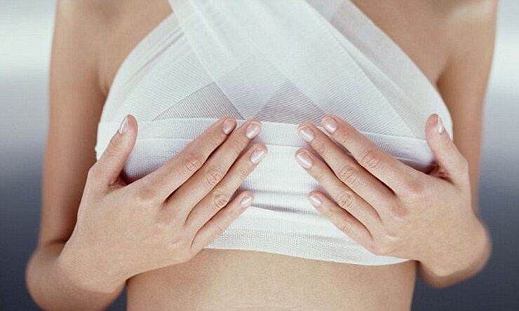 Bandaged breasts after breast augmentation surgery.